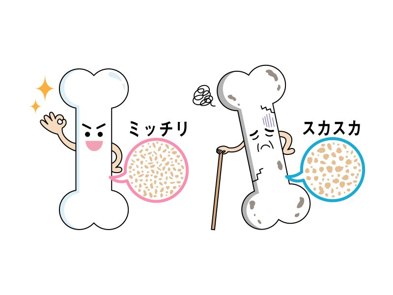 よく聞くけど骨密度って何？