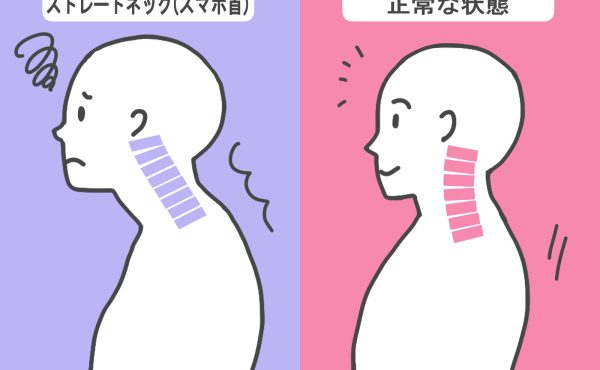 首、肩のコリがひどい？スマホの見過ぎかも...