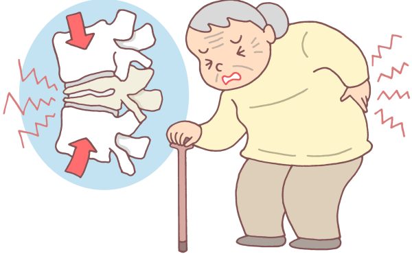 骨粗鬆症について知っていますか？